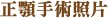 正顎手術照片